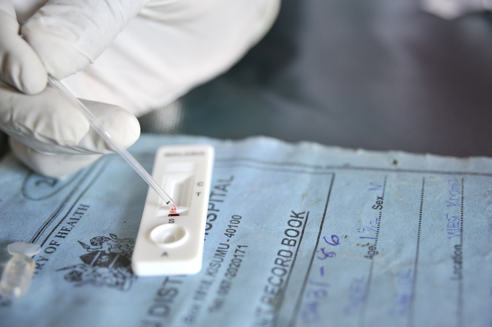 Malaria Rapid Diagnostic Test(link is external). Photo credit: USAID, WikiCommons.